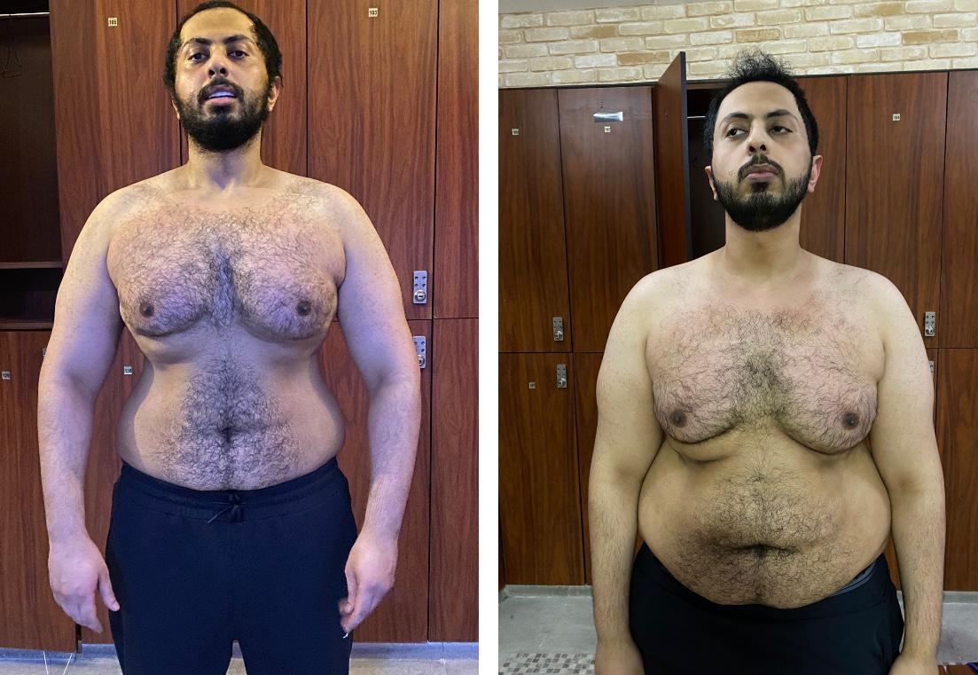 Client after an 18 kg weight loss