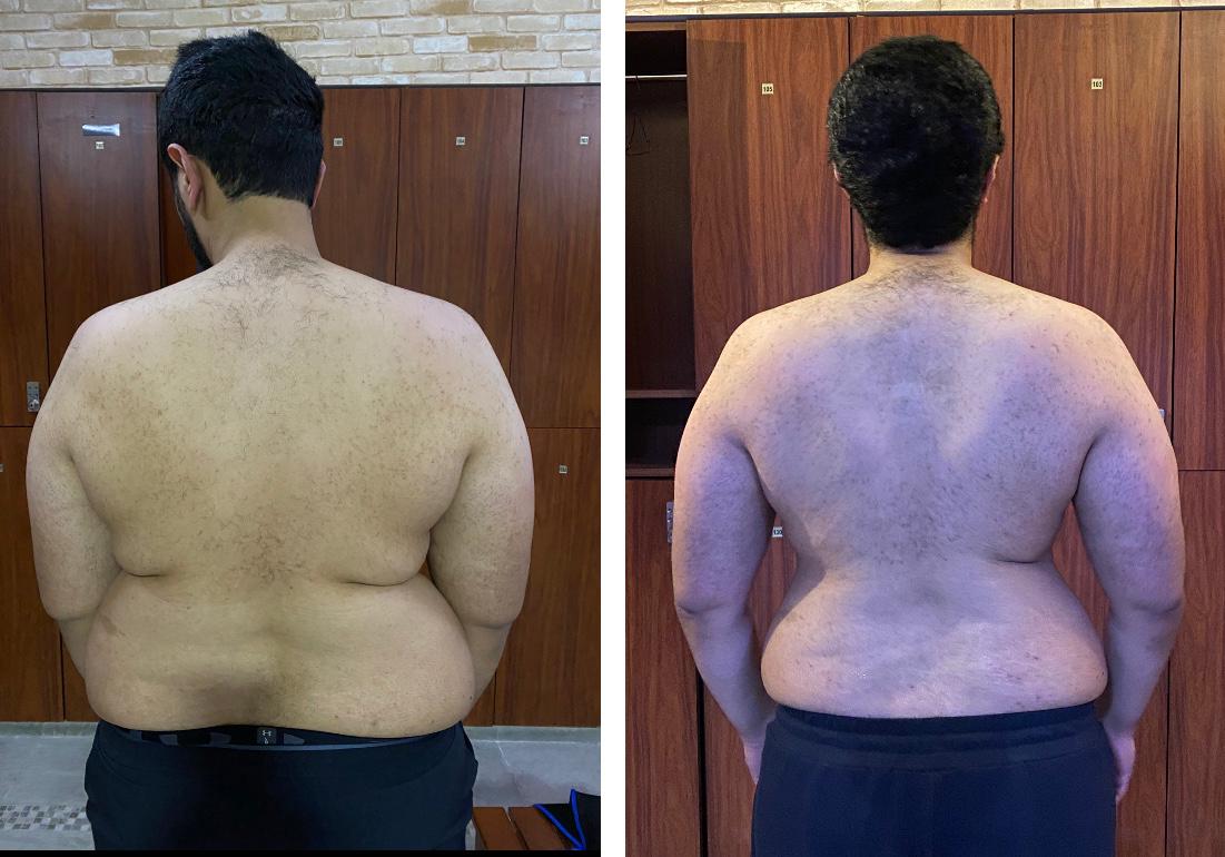 Client back development after 9 kg of muscle gain